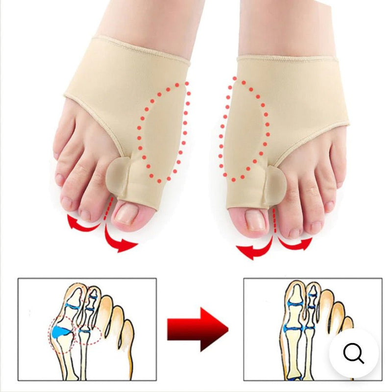 Orthopedic Bunion Corrector (Pair)